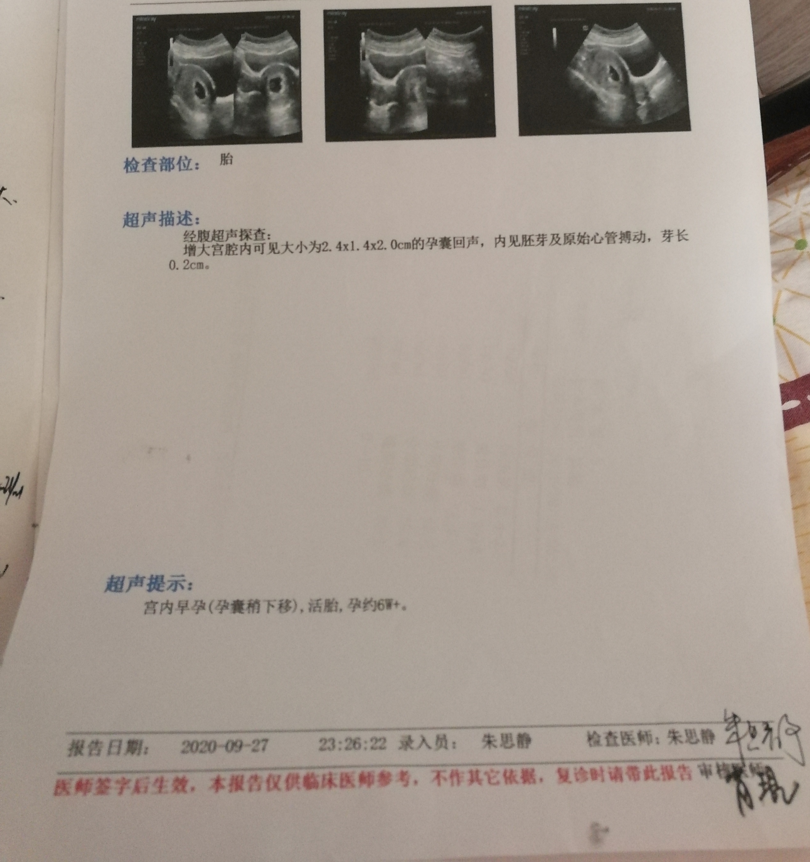 宝儿的第一张照片